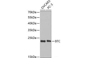 Western blot analysis of extracts of various cell lines using BTC Polyclonal Antibody at dilution of 1:1000. (Betacellulin antibody)