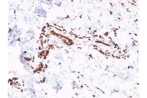 Formalin-fixed, paraffin-embedded human Skin stained with Collagen VII Mouse Monoclonal Antibody (LH7. (COL7A1 antibody)