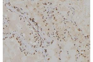 ABIN6279359 at 1/100 staining Human lung tissue by IHC-P. (POLA2 antibody  (Internal Region))