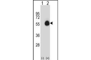 Western blot analysis of CD33 (arrow) using rabbit polyclonal CD33 Antibody (Center) (ABIN657464 and ABIN2846492). (CD33 antibody  (AA 88-117))