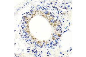 Immunohistochemistry of paraffin-embedded mouse lung using ENDOG antibody (ABIN5997672) at dilution of 1/100 (40x lens).