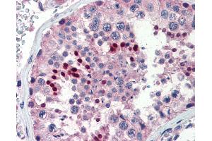 Immunohistochemistry (IHC) image for anti-Nuclear Receptor Subfamily 0, Group B, Member 1 (NR0B1) (AA 359-408) antibody (ABIN462167)