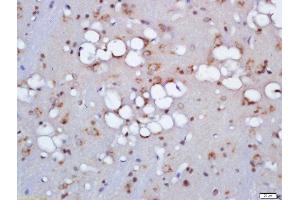 Formalin-fixed and paraffin embedded rat brain labeled with Anti-ZNRF3 Polyclonal Antibody, Unconjugated  at 1:200 followed by conjugation to the secondary antibody and DAB staining