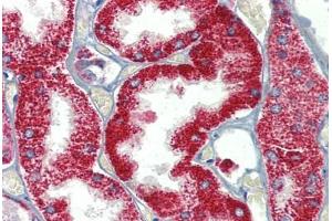 Kidney, Human: Formalin-Fixed, Paraffin-Embedded (FFPE) (SH3BP2 antibody  (AA 432-481))