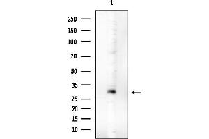 anti-Mitochondrial Fission Factor (MFF) (pSer146), (pSer172) antibody
