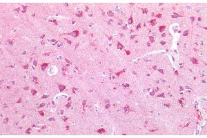 Immunohistochemistry of paraffin-embedded Human adrenal tissue using NPTX1 Polyclonal Antibody at dilution of 1:100. (NPX1 antibody)