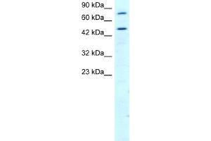 WB Suggested Anti-RGS9 Antibody Titration:  2. (RGS antibody  (N-Term))