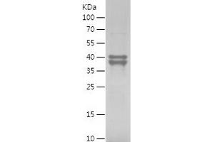 Western Blotting (WB) image for Mdm2, p53 E3 Ubiquitin Protein Ligase Homolog (Mouse) (MDM2) (AA 1-300) protein (His tag) (ABIN7123866) (MDM2 Protein (AA 1-300) (His tag))