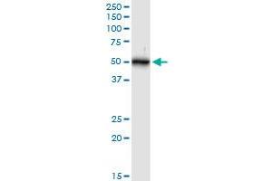 KRT16 MaxPab rabbit polyclonal antibody. (KRT16 antibody  (AA 1-473))