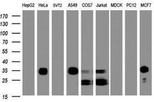 Image no. 7 for anti-Palmitoyl-Protein Thioesterase 1 (PPT1) (AA 100-306) antibody (ABIN1490802)