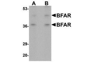 Western blot analysis of BFAR in human kidney tissue lysate with AP30141PU-N BFAR antibody at (A) 1 and (B) 2 μg/ml. (BFAR antibody  (C-Term))
