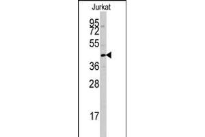 Western blot analysis of PTPN7 polyclonal antibody  in Jurkat cell line lysates (35 ug/lane).