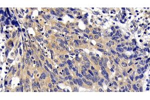 Immunohistochemistry (IHC) image for anti-Apoptotic Peptidase Activating Factor 1 (APAF1) (AA 31-350) antibody (ABIN7433081)