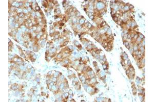 Image no. 1 for anti-CD63 (CD63) antibody (ABIN6187977) (CD63 antibody)
