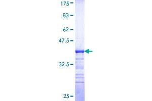 MAP4K1 Protein (AA 278-377) (GST tag)