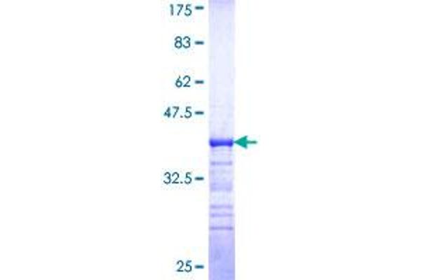 MAP4K1 Protein (AA 278-377) (GST tag)