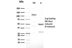 SDS-PAGE Analysis Purified G-CSF Recombinant Rabbit Monoclonal Antibody (CSF3/3166R). (Recombinant G-CSF antibody)