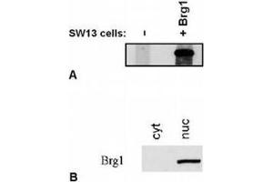 Western Blotting (WB) image for anti-SWI/SNF Related, Matrix Associated, Actin Dependent Regulator of Chromatin, Subfamily A, Member 4 (SMARCA4) (C-Term) antibody (ABIN614772) (SMARCA4 antibody  (C-Term))