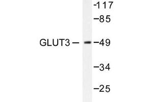 Image no. 1 for anti-Solute Carrier Family 2 (Facilitated Glucose Transporter), Member 3 (SLC2A3) antibody (ABIN265443) (SLC2A3 antibody)