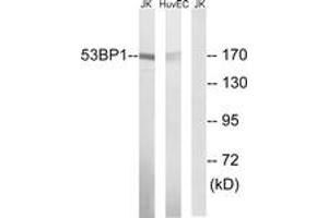 Western blot analysis of extracts from Jurkat/HuvEc cells, using 53BP1 (Ab-29) Antibody. (TP53BP1 antibody  (AA 14-63))
