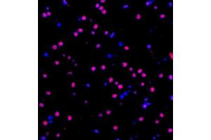 ZNF682 antibody