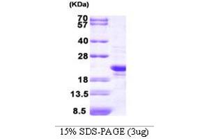 SDS-PAGE (SDS) image for Peroxiredoxin 2 (PRDX2) (AA 1-198) protein (ABIN667730) (Peroxiredoxin 2 Protein (PRDX2) (AA 1-198))