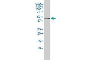 TES monoclonal antibody (M01), clone 1G11-B7 Western Blot analysis of TES expression in K-562 . (TES antibody  (AA 1-421))