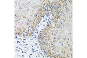 Immunohistochemistry of paraffin-embedded human esophagus using CPM antibody (ABIN6128978, ABIN6138956, ABIN6138957 and ABIN6222238) at dilution of 1:100 (40x lens). (CPM antibody  (AA 204-443))