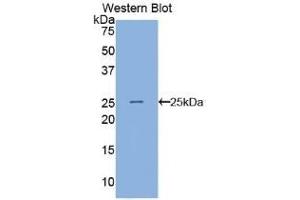 Detection of Recombinant ANGPTL8, Human using Polyclonal Antibody to Angiopoietin Like Protein 8 (ANGPTL8) (C19ORF80 antibody  (AA 24-196))