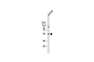 Anti-NETO2 Antibody (N-term ) at 1:2000 dilution + Jurkat whole cell lysate Lysates/proteins at 20 μg per lane. (NETO2 antibody  (N-Term))