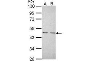 Image no. 1 for anti-Nuclear Receptor Subfamily 2, Group C, Member 1 (NR2C1) (AA 1-220) antibody (ABIN467508) (NR2C1 antibody  (AA 1-220))