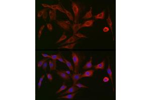 Immunofluorescence (IF) image for anti-Polymeric Immunoglobulin Receptor (PIGR) (AA 661-764) antibody (ABIN6145618)