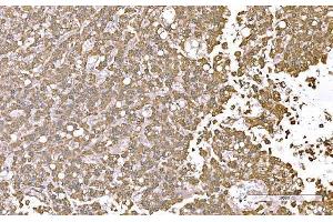IHC analysis of SND1 using anti-SND1 antibody (ABIN7600525).
