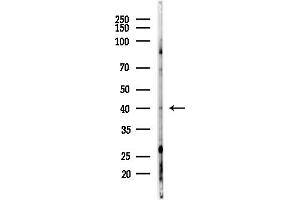 anti-Forkhead Box H1 (FOXH1) (Internal Region) antibody