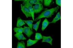 Immunofluorescenitrocellulosee of human HeLa cells stained with Hoechst 33342 (Blue) and monoclonal anti-Hexokinase antibody (1:1000) with Alexa 488 (Green).