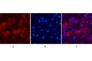 Immunofluorescence analysis of mouse brain tissue. (Ubiquitin antibody)