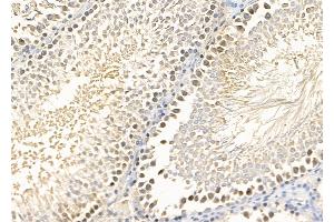 ABIN7094438 and ABIN7098486 at 1/100 staining Rat testis tissue by IHC-P. (FOXG1 antibody  (C-Term))