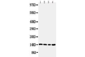 Anti-Stefin B antibody, Western blotting Lane 1: A549 Cell Lysate Lane 2: A431 Cell Lysate Lane 3: COLO320 Cell Lysate Lane 4: HELA Cell Lysate (CSTB antibody  (Middle Region))