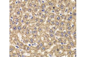 Immunohistochemistry of paraffin-embedded Rat liver using UBE2J2 Polyclonal Antibody at dilution of 1:100 (40x lens). (UBE2J2 antibody)