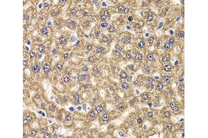 Immunohistochemistry of paraffin-embedded Rat liver using UBE2J2 Polyclonal Antibody at dilution of 1:100 (40x lens).