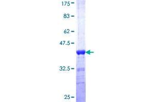 Image no. 1 for Splicing Factor Proline/glutamine-Ric (SFPQ) (AA 269-361) protein (GST tag) (ABIN1319733) (SFPQ Protein (AA 269-361) (GST tag))