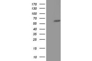 Western Blotting (WB) image for anti-Kelch-Like 2, Mayven (KLHL2) (AA 1-100), (AA 494-593) antibody (ABIN1490550)