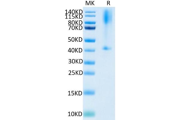 Glypican 3 Protein (GPC3) (AA 25-559) (His-Avi Tag,Biotin)