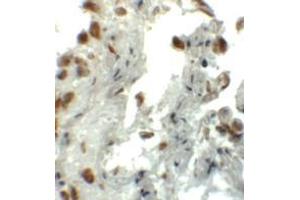Immunohistochemistry (IHC) image for anti-Enhancer of Zeste Homolog 1 (EZH1) (N-Term) antibody (ABIN1031377) (EZH1 antibody  (N-Term))