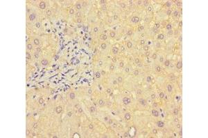 Immunohistochemistry of paraffin-embedded human liver tissue using ABIN7145396 at dilution of 1:100 (B4GALT5 antibody  (AA 101-388))