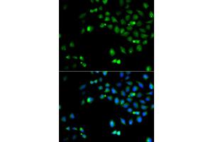 Immunofluorescence analysis of A549 cell using HOXA1 antibody. (HOXA1 antibody)