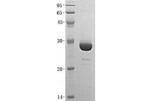Validation with Western Blot (CA7 Protein (Transcript Variant 2))