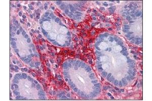 Immunohistochemistry (IHC) image for anti-Apolipoprotein A-II (APOA2) (AA 1-101) antibody (ABIN614396) (APOA2 antibody  (AA 1-101))