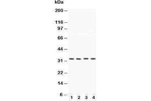 Western blot testing of Caspase-7 antibody and Lane 1:  HeLa;  2: MCF-7;  3: rat liver;  4: rat kidney (Caspase 7 antibody  (AA 237-255))