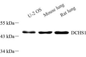 Western blot analysis of DCHS1 (ABIN7073689),at dilution of 1: 800 (DCHS1 antibody)